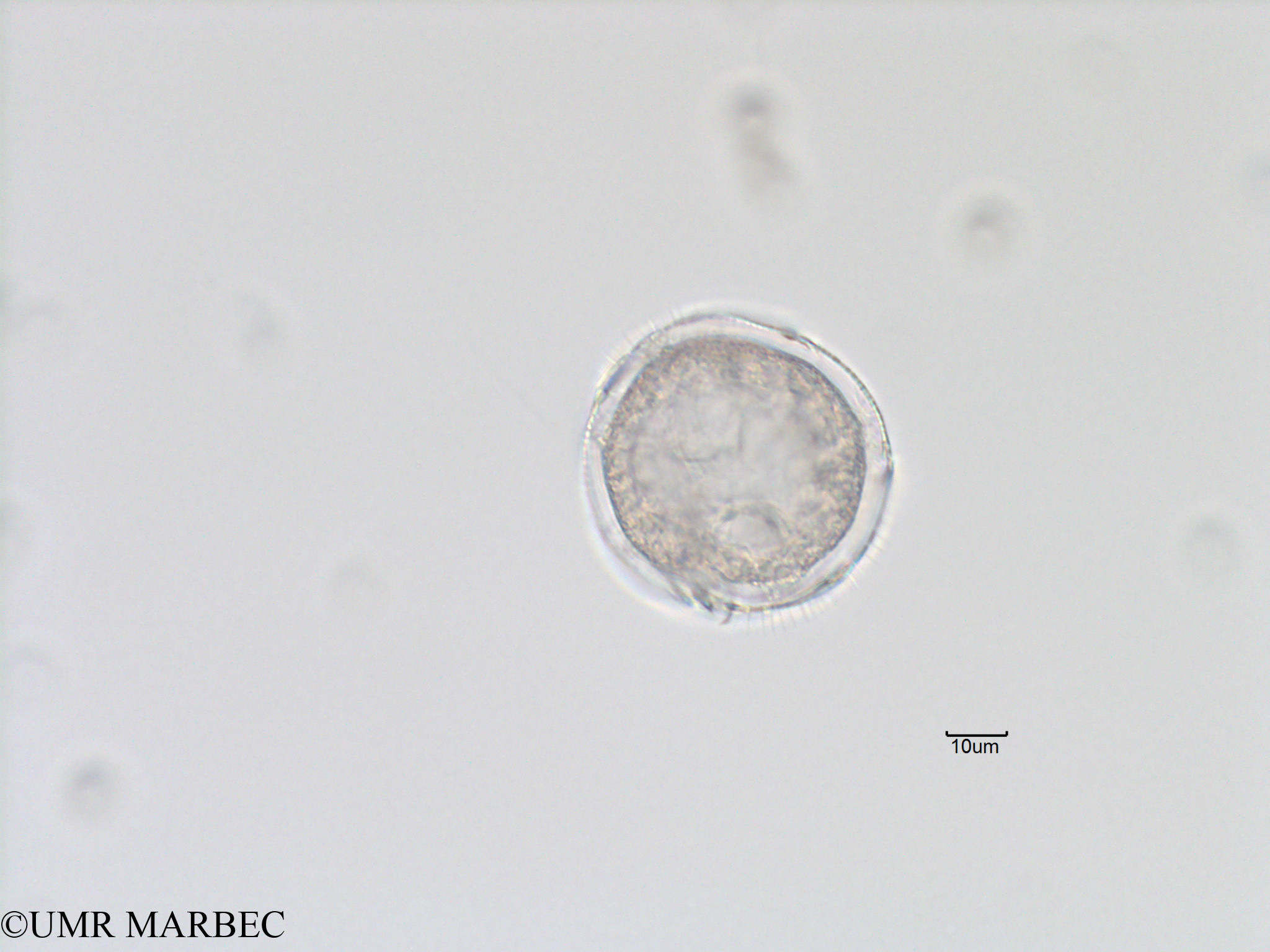 phyto/Bizerte/bizerte_bay/RISCO November 2015/Protoperidinium sp46 (Baie_T5-C3-dino avzc suture-23).tif(copy).jpg